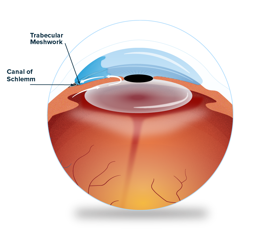 Diagram labeling the trabecular meshwork and canal of Schlemm in the eye